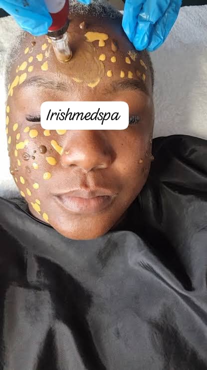 BB GLOW FACIALS (Semi-Permanent foundation)