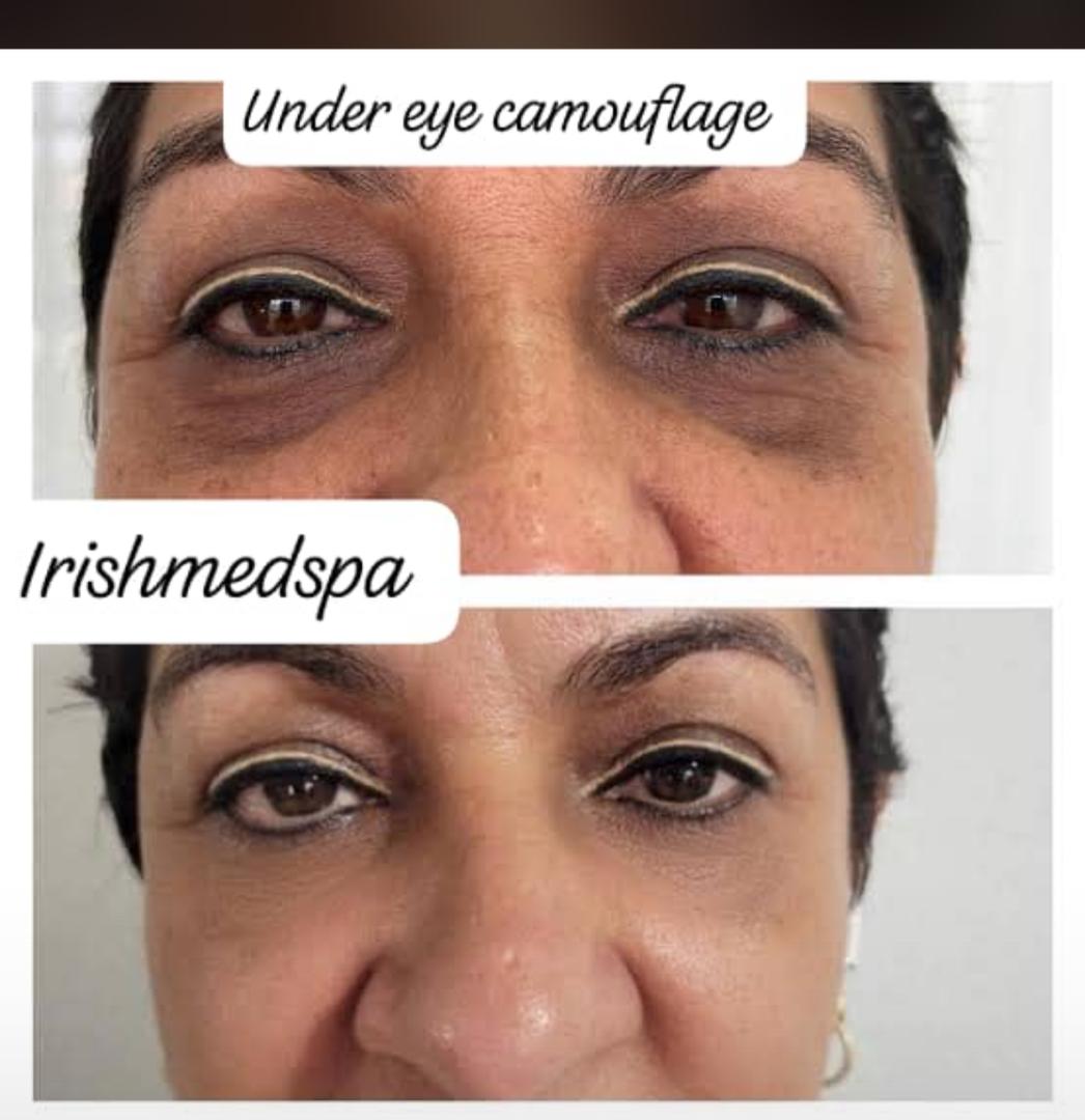 Under eye camouflage